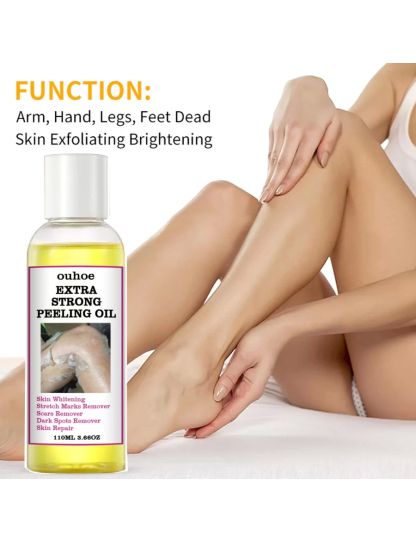 110ml Yellow Peeling Oil Plant Essential Bleaching Lighten Elbows Knee Hands Brightening Skin Tone Facial Body Massage Oil